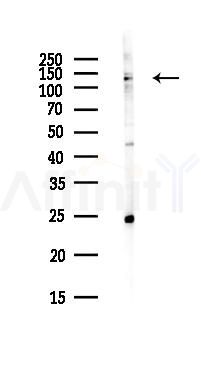 USP7 Antibody - Western blot analysis of lysates from PC12 cells(LPS, 4h treatment), using USP7 Antibody at 1/1000 dilution.
