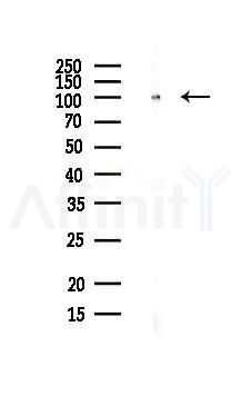TIF1 beta Antibody - Western blot analysis of lysates from PC12 cells(LPS, 4h treatment), using TIF1 beta Antibody at 1/1000 dilution.