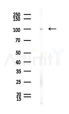 TIF1 beta Antibody - Western blot analysis of lysates from Rat liver, using TIF1 beta Antibody at 1/1000 dilution.