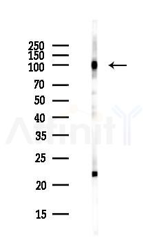TIF1 beta Antibody - Western blot analysis of lysates from COLO205 cells(heat-shock,45min treatment), using TIF1 beta Antibody at 1/1000 dilution.