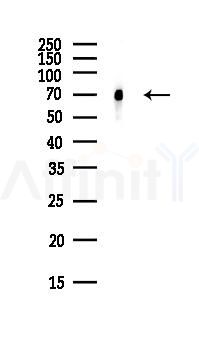 DDX5 Antibody - Western blot analysis of lysates from PC12 cells(LPS, 4h treatment), using DDX5 Antibody at 1/1000 dilution.