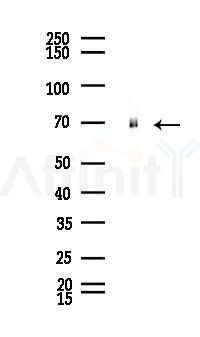 DDX5 Antibody - Western blot analysis of lysates from Rat liver, using DDX5 Antibody at 1/1000 dilution.