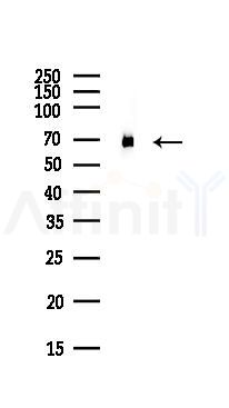 DDX5 Antibody - Western blot analysis of lysates from COLO205 cells(heat-shock,45min treatment), using DDX5 Antibody at 1/1000 dilution.