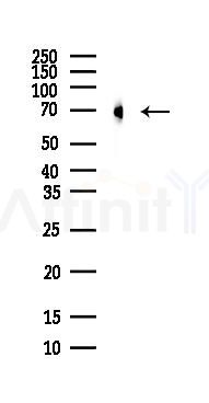 DDX5 Antibody - Western blot analysis of lysates from Mouse brain, using DDX5 Antibody at 1/1000 dilution.