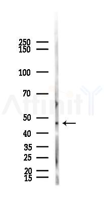 PAX6 Antibody - Western blot analysis of lysates from B16F10-LUC cells(starvation,24h treatment), using PAX6 Antibody at 1/1000 dilution.