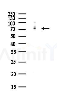NUMB Antibody - Western blot analysis of lysates from PC12 cells(LPS, 4h treatment), using NUMB Antibody at 1/1000 dilution.