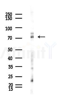 NUMB Antibody - Western blot analysis of lysates from Rat liver, using NUMB Antibody at 1/1000 dilution.