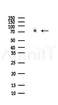 NUMB Antibody - Western blot analysis of lysates from Mouse brain, using NUMB Antibody at 1/1000 dilution.
