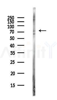 KCNQ1 Antibody - Western blot analysis of lysates from PC12 cells(LPS, 4h treatment), using KCNQ1 Antibody at 1/1000 dilution.