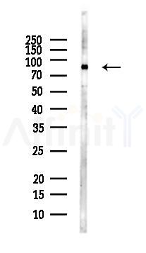 Phospho-PKC epsilon (Ser729) Antibody - Western blot analysis of lysates from PC12 cells(LPS, 4h treatment), using Phospho-PKC epsilon (Ser729) Antibody at 1/1000 dilution.