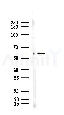 NLK Antibody - Western blot analysis of lysates from B16F10-LUC cells(starvation,24h treatment), using NLK Antibody at 1/1000 dilution.