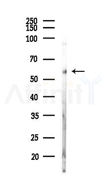 NLK Antibody - Western blot analysis of lysates from PC12 cells(UV,30min treatment), using NLK Antibody at 1/1000 dilution.