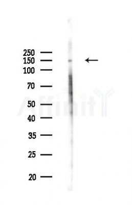 Phospho-PERK (Thr982) Antibody - Western blot analysis of lysates from B16F10-LUC cells(UV,30min treatment), using Phospho-PERK (Thr982) Antibody at 1/1000 dilution.