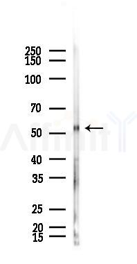 APG5L/ATG5 Antibody - Western blot analysis of lysates from B16F10-LUC cells(starvation,24h treatment), using APG5L/ATG5 Antibody at 1/1000 dilution.