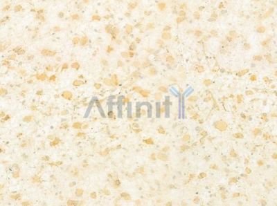Rab10 Antibody - DF7582 at 1/100 staining human astrocytoma by IHC-P.