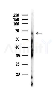 PDI Antibody - Western blot analysis of lysates from HepG2 cells(heat-shock,45min treatment), using PDI Antibody at 1/1000 dilution.