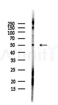 Perilipin-1 Antibody - Western blot analysis of lysates from PC12 cells(LPS, 4h treatment), using Perilipin-1 Antibody at 1/1000 dilution.