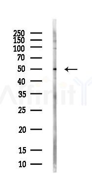 ADFP Antibody - Western blot analysis of lysates from PC12 cells(LPS, 4h treatment), using ADFP Antibody at 1/1000 dilution.
