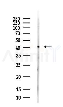 Glutamine Synthetase Antibody - Western blot analysis of lysates from PC12 cells(LPS, 4h treatment), using Glutamine Synthetase Antibody at 1/1000 dilution.