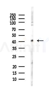 Glutamine Synthetase Antibody - Western blot analysis of lysates from COLO205 cells(heat-shock,45min treatment), using Glutamine Synthetase Antibody at 1/1000 dilution.