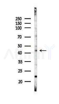 Doublecortin Antibody - Western blot analysis of lysates from HepG2 cells(heat-shock,45min treatment), using Doublecortin Antibody at 1/1000 dilution.