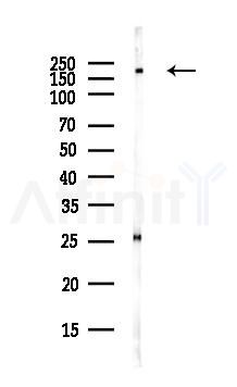 eIF4G1 Antibody - Western blot analysis of lysates from COLO205 cells(heat-shock,45min treatment), using eIF4G1 Antibody at 1/1000 dilution.
