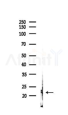 HRAS Antibody - Western blot analysis of lysates from Rat brain, using HRAS Antibody at 1/1000 dilution.