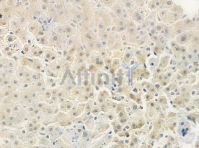 C11orf30 Antibody - DF7645 at 1/100 staining human normal liver tissue by IHC-P.