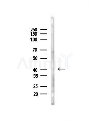CYTH3 Antibody - Western blot analysis of lysates from HepG2 cells(heat-shock, 45min treatment), using CYTH3 Antibody at 1/1000 dilution.