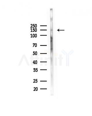 INSRR Antibody - Western blot analysis of lysates from PC12 cells(heat-shock, 45min treatment), using INSRR Antibody at 1/1000 dilution.