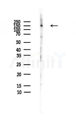 NEFM Antibody - Western blot analysis of lysates from HepG2 cells(heat-shock,45min treatment), using NEFM Antibody at 1/1000 dilution.