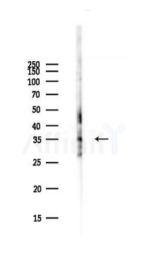 CD40L Antibody - Western blot analysis of lysates from PC12 cells(starvation,24h treatment), using CD40L Antibody at 1/1000 dilution.