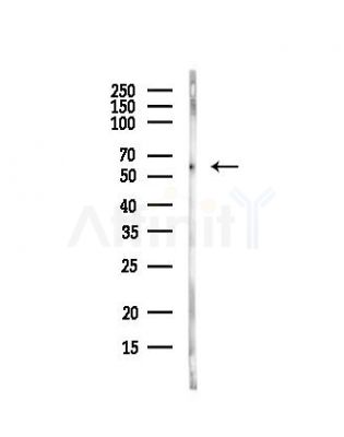 CD80 Antibody - Western blot analysis of lysates from Rat lung, using CD80 Antibody at 1/1000 dilution.