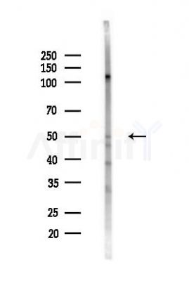 SUFU Antibody - Western blot analysis of lysates from LoVo cells(heat-shock,45min treatment), using SUFU Antibody at 1/1000 dilution.