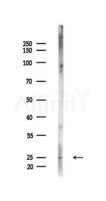 CRADD Antibody - Western blot analysis of lysates from Rat brain, using CRADD Antibody at 1/1000 dilution.