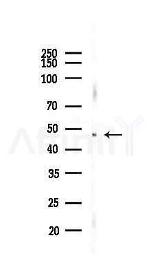 Pannexin-3 Antibody - Western blot analysis of lysates from A375 cells(heat-shock,45min treatment), using Pannexin-3 Antibody at 1/1000 dilution.