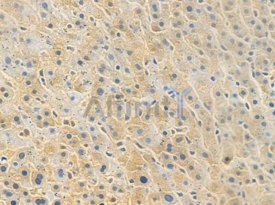 ILP2 Antibody - DF7725 at 1/100 staining human normal liver tissue by IHC-P.