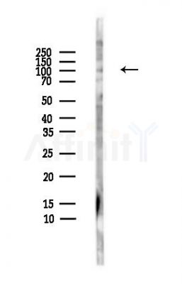 GPR48 Antibody - Western blot analysis of lysates from HepG2 cells(heat-shock,45min treatment), using GPR48 Antibody at 1/1000 dilution.