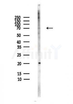 PINK1 Antibody - Western blot analysis of lysates from HepG2 cells(heat-shock,45min treatment), using PINK1 Antibody at 1/1000 dilution.