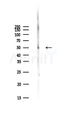 PINK1 Antibody - Western blot analysis of lysates from PC12 cells(starvation,24h treatment), using PINK1 Antibody at 1/1000 dilution.