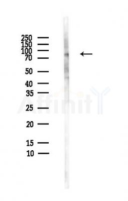 Choline Acetyltransferase Antibody - Western blot analysis of lysates from HepG2 cells(heat-shock,45min treatment), using Choline Acetyltransferase Antibody at 1/1000 dilution.