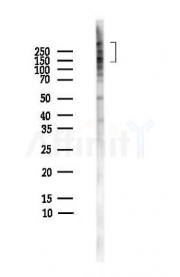 Nestin Antibody - Western blot analysis of lysates from HepG2 cells(heat-shock,45min treatment), using Nestin Antibody at 1/1000 dilution.