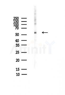 PNPLA2 Antibody - Western blot analysis of lysates from HepG2 cells(heat-shock,45min treatment), using PNPLA2 Antibody at 1/1000 dilution.