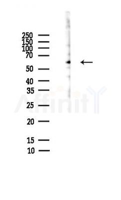 Sall4 Antibody - Western blot analysis of lysates from HepG2 cells(heat-shock,45min treatment), using Sall4 Antibody at 1/1000 dilution.
