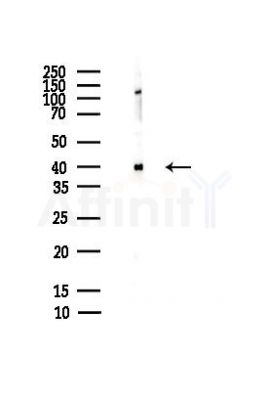 GAP43 Antibody - Western blot analysis of lysates from HepG2 cells(heat-shock,45min treatment), using GAP43 Antibody at 1/1000 dilution.