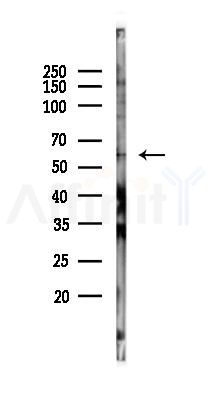 Phospho-PKM2 (Tyr105) Antibody - Western blot analysis of lysates from Hela cells(LPS, 4h treatment), using Phospho-PKM2 (Tyr105) Antibody at 1/1000 dilution.