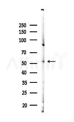 ESRRA Antibody - Western blot analysis of lysates from A375 cells(heat-shock,45min treatment), using ESRRA Antibody at 1/1000 dilution.