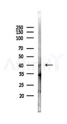 SOAT1 Antibody - Western blot analysis of lysates from Hela cells(LPS, 4h treatment), using SOAT1 Antibody at 1/1000 dilution.