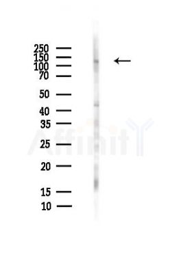 RBL2 Antibody - Western blot analysis of lysates from HepG2 cells(heat-shock,45min treatment), using RBL2 Antibody at 1/1000 dilution.