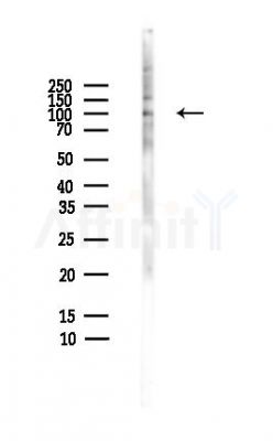 GABBR2 Antibody - Western blot analysis of lysates from HepG2 cells(heat-shock,45min treatment), using GABBR2 Antibody at 1/1000 dilution.